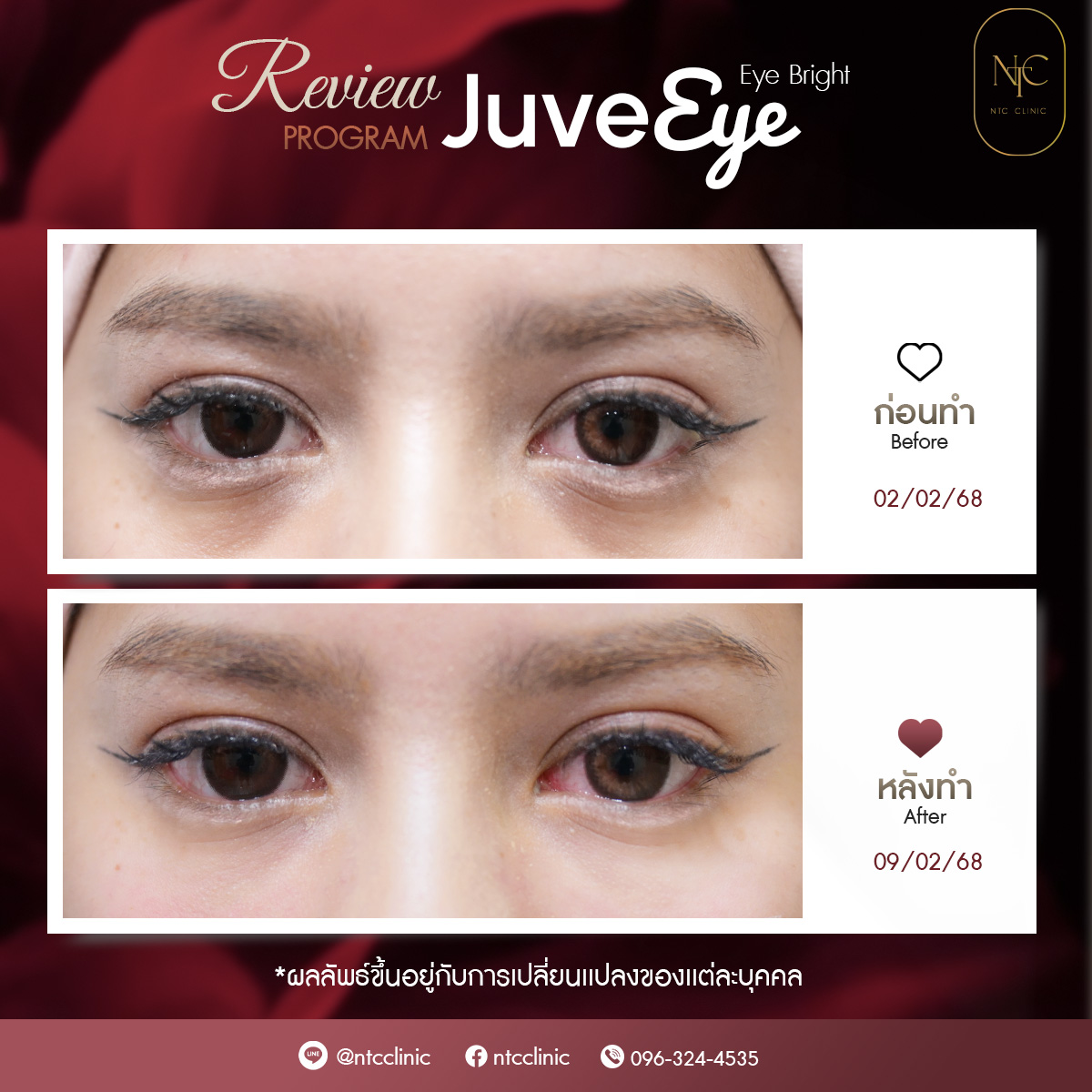 Eye_2