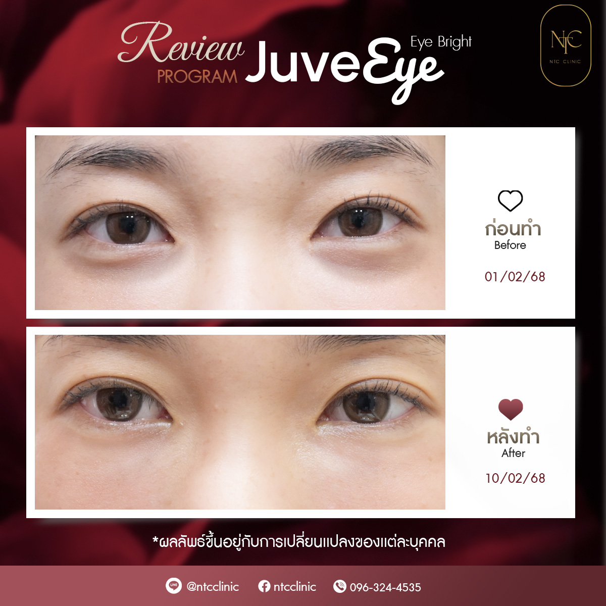 Eye_3