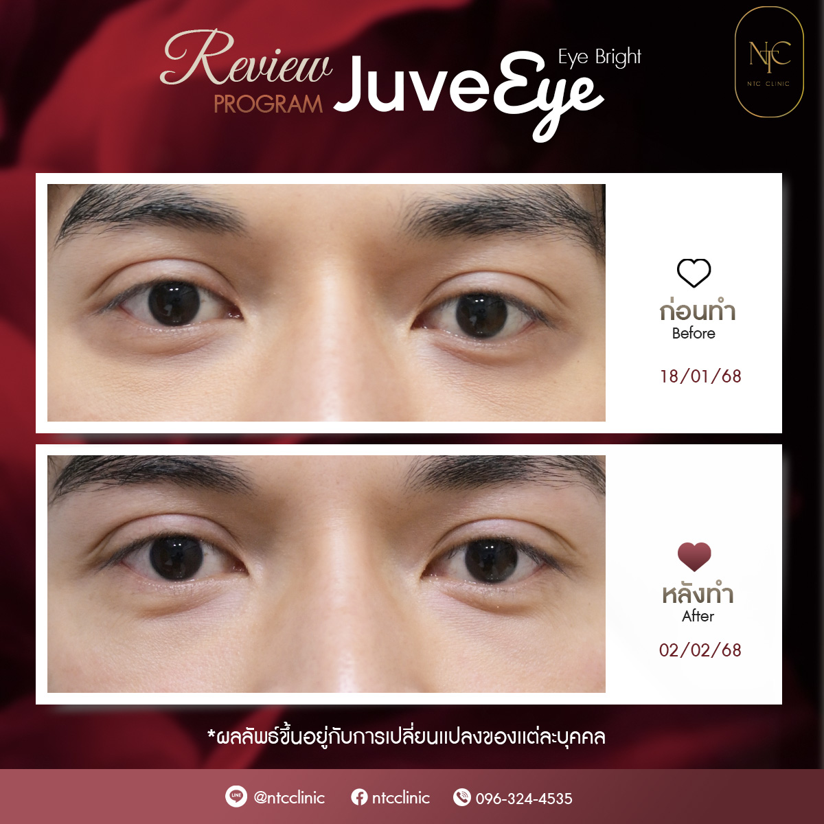 Eye_4
